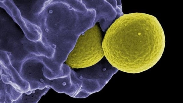 My upcoming webinars on ways to support the immune system